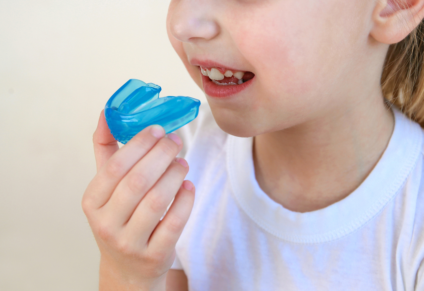 マイオブレース:1期治療(5歳〜12歳)